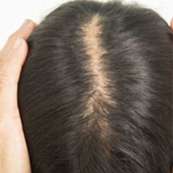 Biotin Hair Gummies for Hair Growth: Vegan Multivitamin Gummies Biotin Hair Gummies for Hair Growth: Vegan Multivitamin Gummies