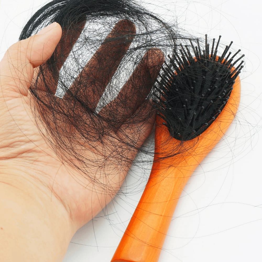 PCOS Hair Loss: Cause, Treatment & Home Remedies