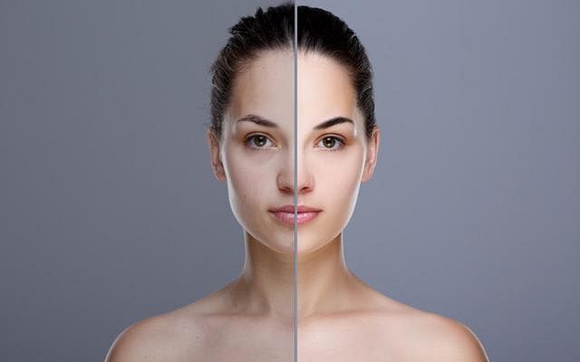 uneven-skin-tone-before-and-after