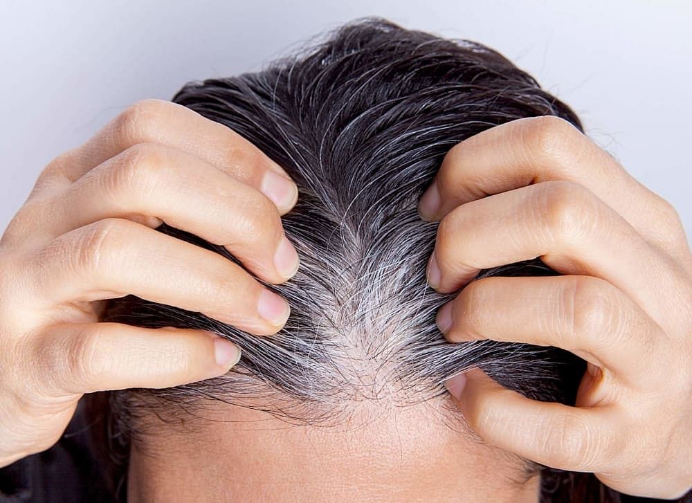 सफेद बालों का इलाज | White Hair Treatment in Hindi
