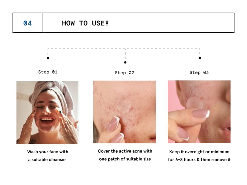 https://ik.bebodywise.com/mosaic-wellness/image/upload/f_auto,w_800,c_limit/v1652359384/staging/products/hydrocolloid-acne-pimple-patch/CAROUSEL/4.png